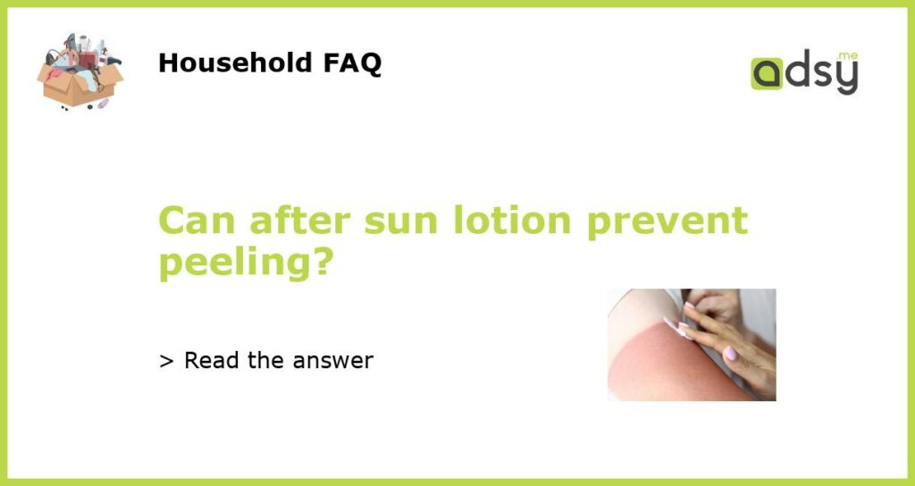 Can after sun lotion prevent peeling featured