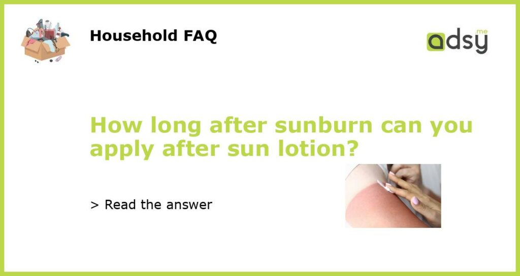 How long after sunburn can you apply after sun lotion featured