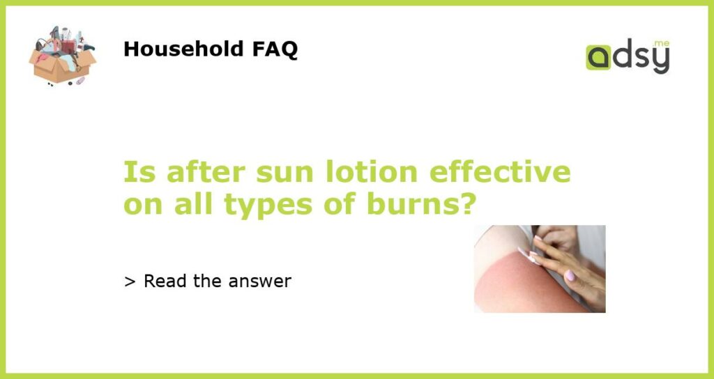 Is after sun lotion effective on all types of burns featured